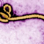 Nigeria Faces Rare Ebola Strain as Officials Intensify Efforts to Contain Abuja Case